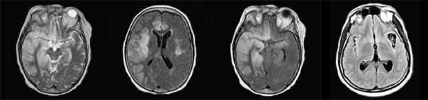 Adanced General Neurology Fellowship