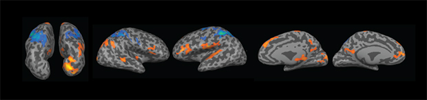 Behavioral Neurology and Neuropsychiatry Fellowship at MGH