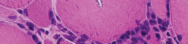 Neuromuscular Medicine