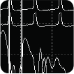 Intra-Operative Neuromonitoring